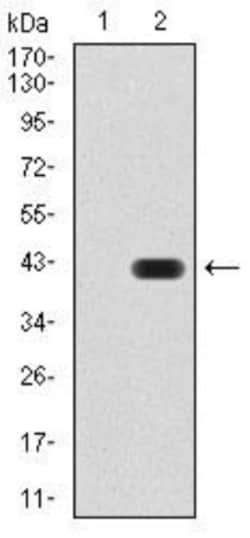 GAD2/GAD65 Antibody (5D9G9) - BSA Free, Novus Biologicals:Antibodies:Primary